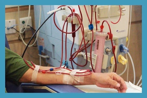 Dialysis Acess